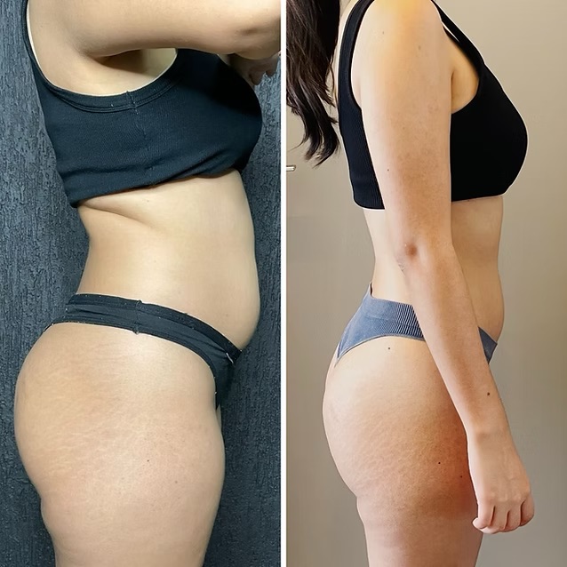 Resultado de Cliente 2